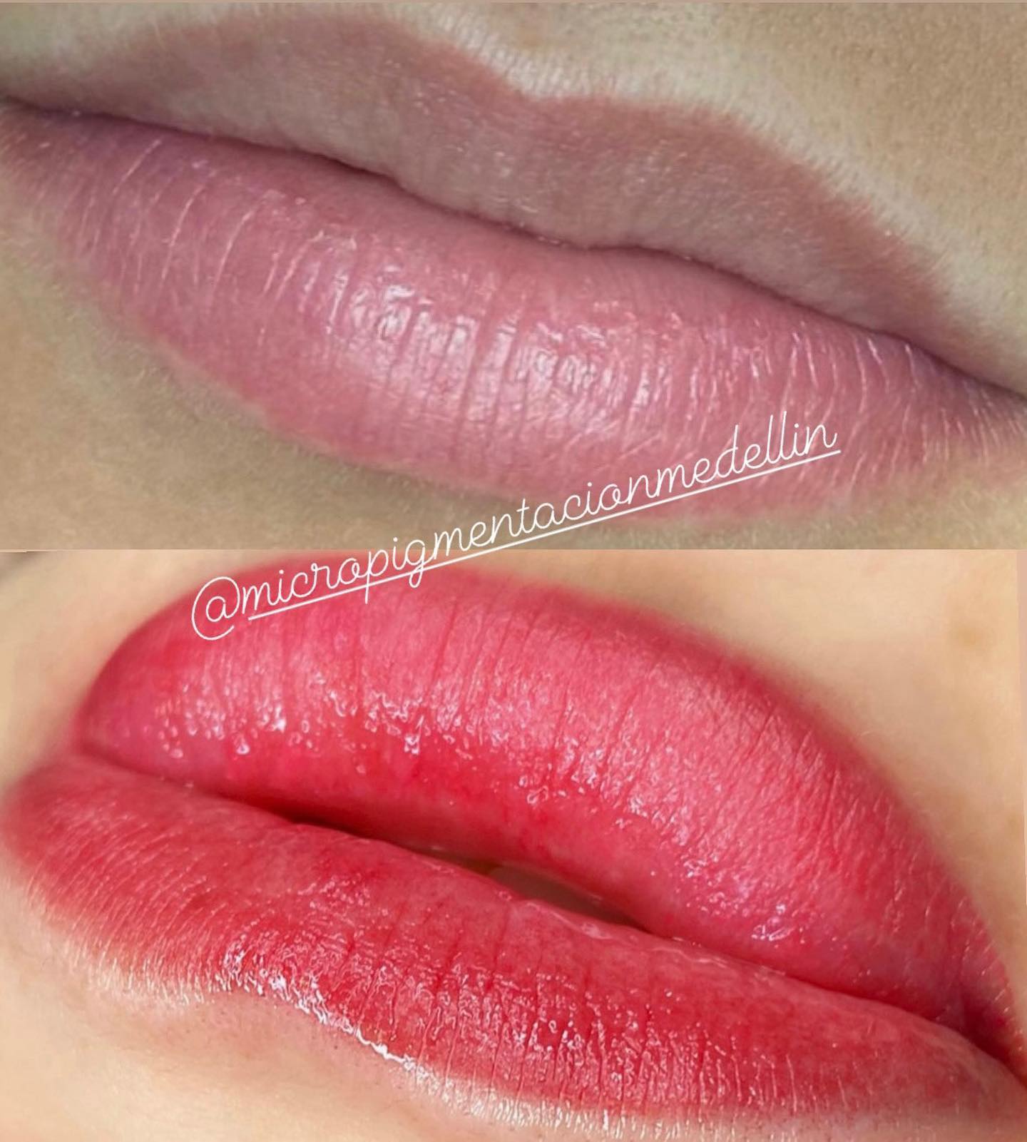 Resultado de micropigmentaci&oacute;n de labios en Sector Estadio