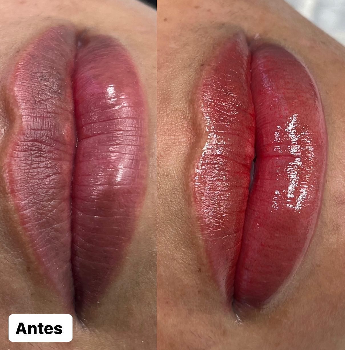 Resultado de micropigmentaci&oacute;n de labios en Robledo - Pigment Pro