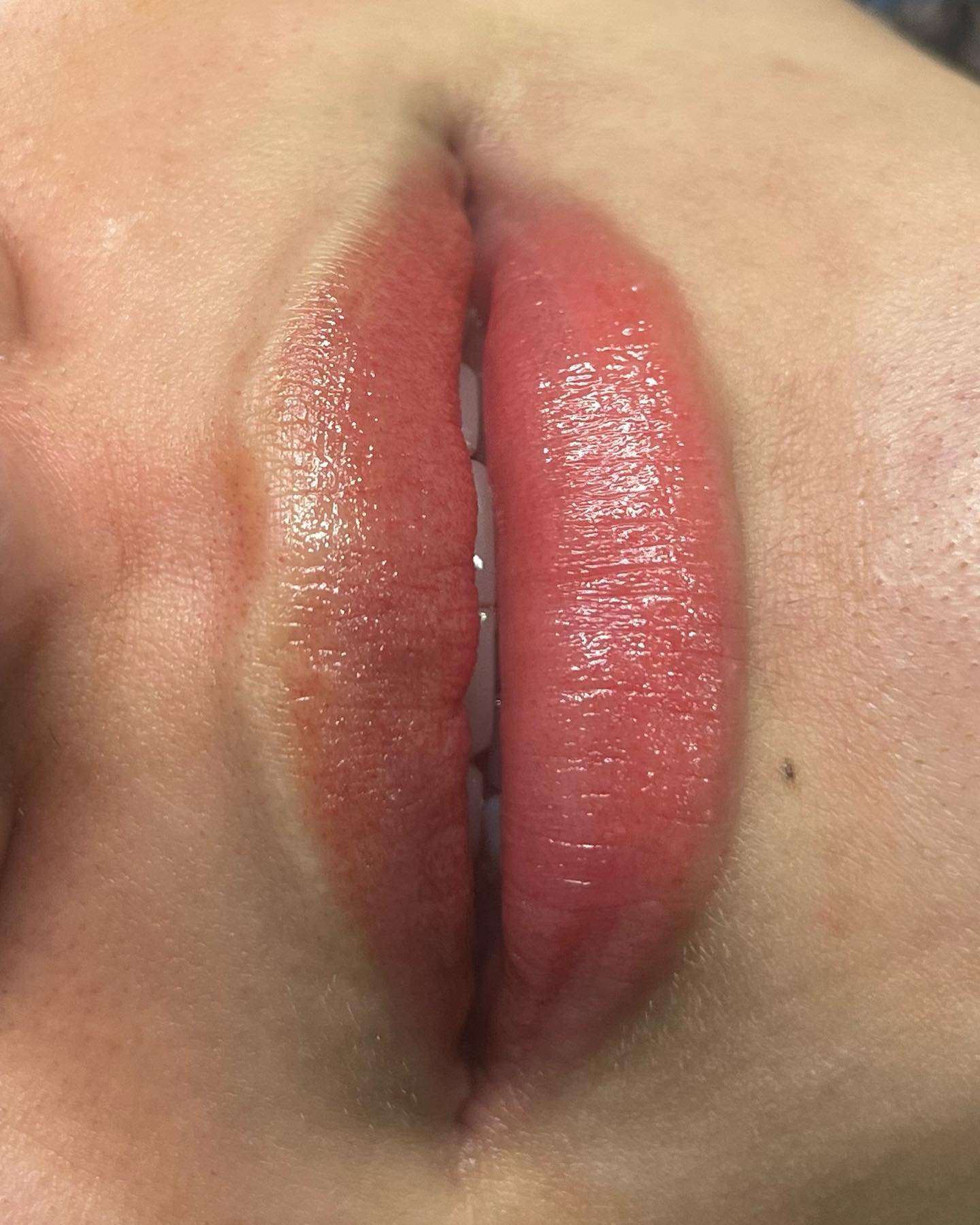 Resultado de micropigmentaci&oacute;n de labios en Sector Estadio