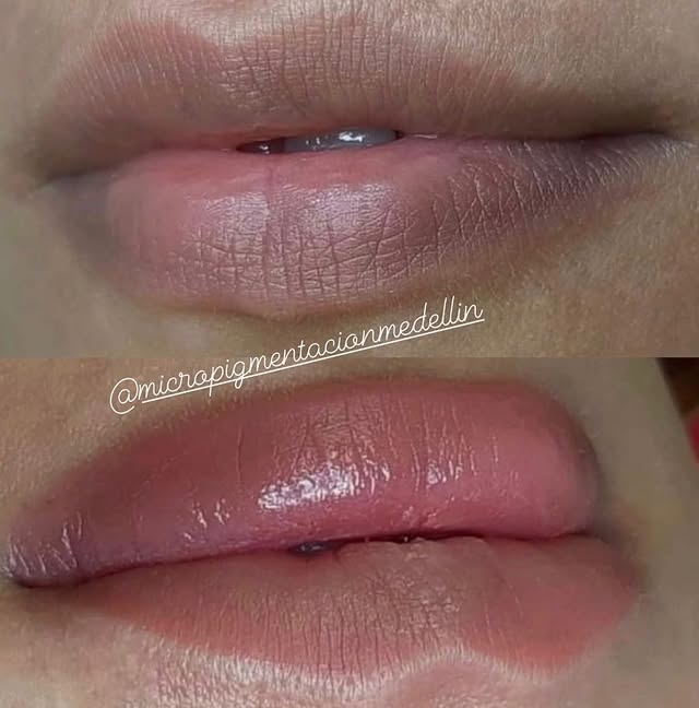 Resultado de micropigmentaci&oacute;n de labios en Sector Estadio