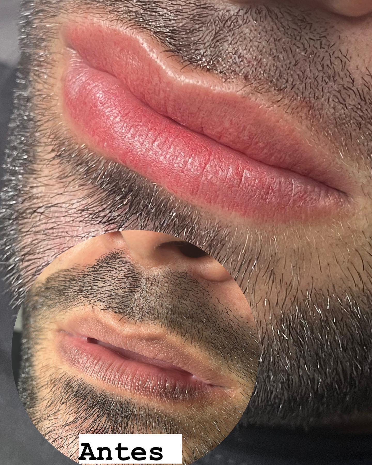 Resultado de micropigmentaci&oacute;n de labios en La Am&eacute;rica - Pigment Pro