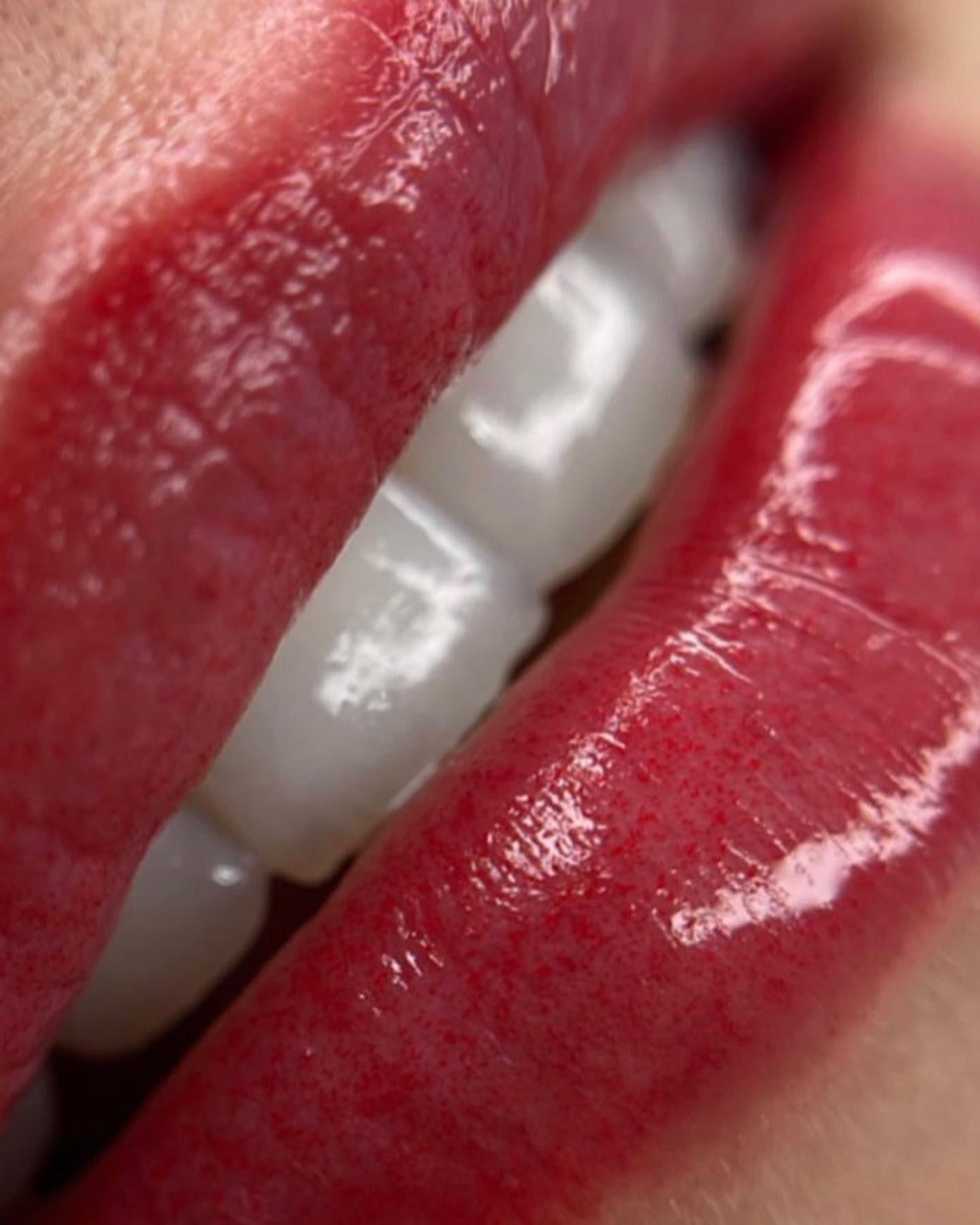 Resultado de micropigmentaci&oacute;n de labios en Bel&eacute;n - Pigment Pro